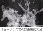 ミュータンス菌の顕微鏡拡大図